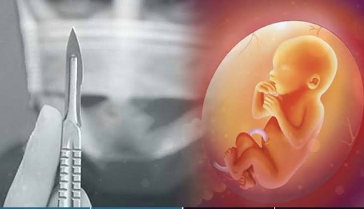 China Berlakukan Kebijakan Ketat tentang Aborsi