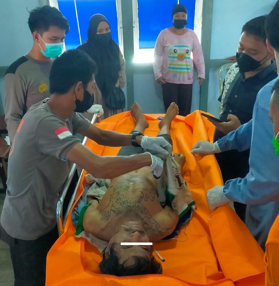 Pulang dari Kebun, Istri Terperanjat Ketemu Suami Tewas Tergantung