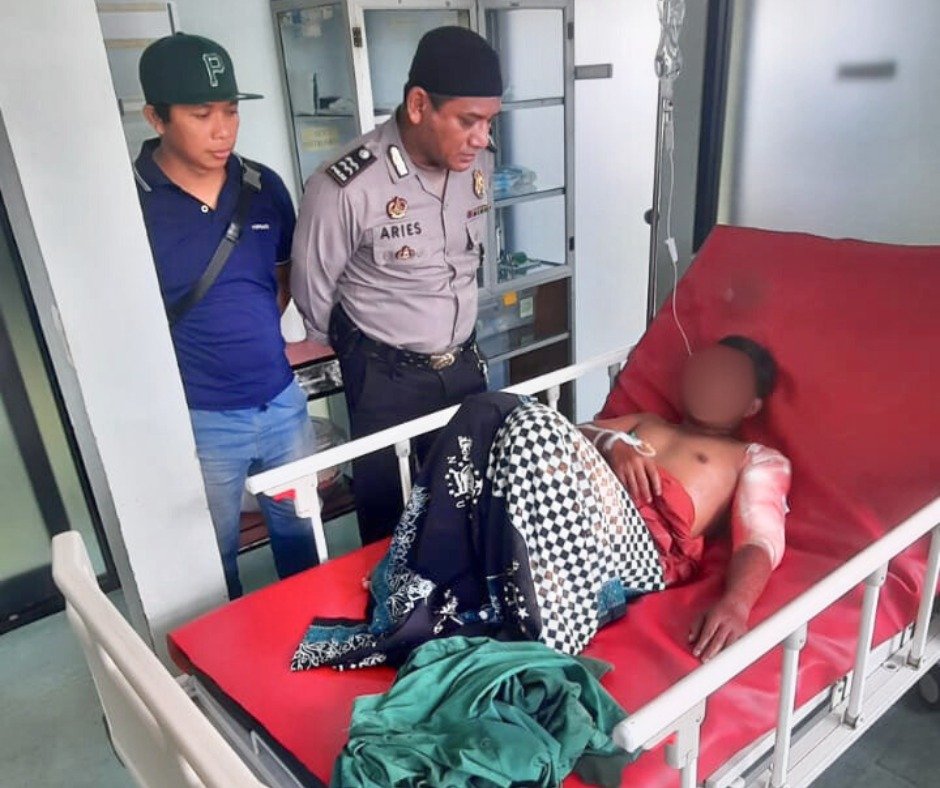 Tabung Gas Balon Rakitan Meledak, Satu Warga Kubu Raya Terluka Parah