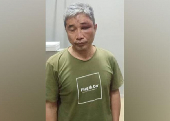 Keterangan foto: Muhammad Kosman alias Muhammad Kece diduga menjadi korban penganiayaan oleh Irjen Pol Napoleon Bonaparte di Rutan Mabes Polri. (Istimewa)