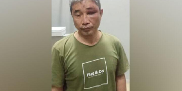 Keterangan foto: Muhammad Kosman alias Muhammad Kece diduga menjadi korban penganiayaan oleh Irjen Pol Napoleon Bonaparte di Rutan Mabes Polri. (Istimewa)