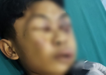 Sujiwo: Saya dan Wabup Tak Bisa Kerja Biasa-biasa Saja